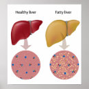 Suche nach verdauung poster Anatomie