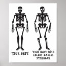 Suche nach ehlers danlos syndrom poster Löffel