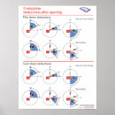 Suche nach trampolinen poster Gymnastik