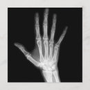 Suche nach radiologie postkarten Röntgenstrahl