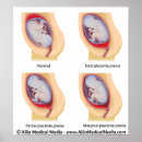 Suche nach obgyn poster Geburt