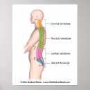 Suche nach wirbelsäule poster Chiropraktisch