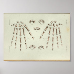 1844 Vintage Anatomie-Druck Handknochen Poster