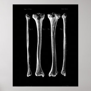 1844 Vintage Anatomie-Druck Tibia Fibula Poster