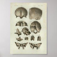 1844 Vintage Anatomie Druckschädel
