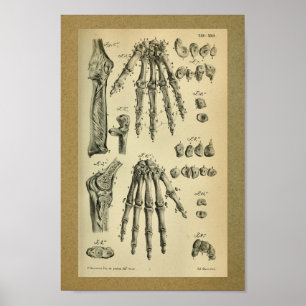 1850 Vintage Anatomie Druckhandknochen Mensch Poster