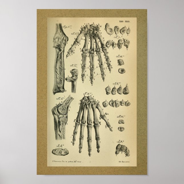 1850 Vintage Anatomie Druckhandknochen Mensch Poster (Vorne)