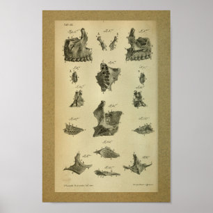 1850 Vintage Anatomie Print Maxilla Poster