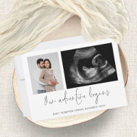 2 Fotos Adventure fängt Schwangerschaft an Ankündi