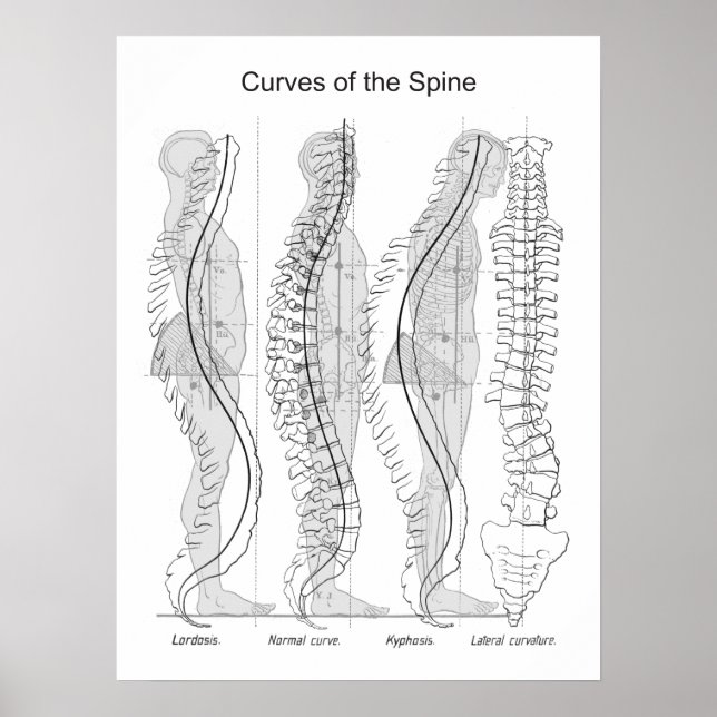 Abnormal Curves of the Spine Poster Chiropractic (Vorne)