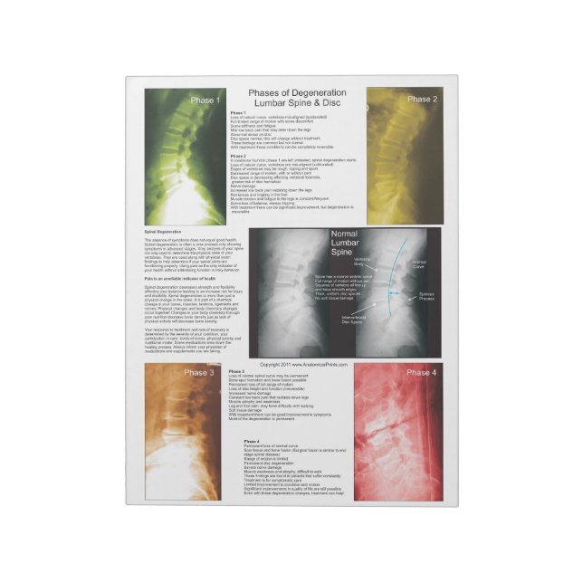 Abreißen der Pad Lumbar Spinalentzündung Notizblock (Rotiert)