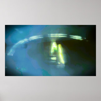 Abstract Arc Light, Poster