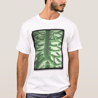 ACWE tragbare Brustradiographie T-Shirt