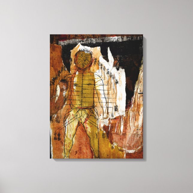 Akupunktur, Collage und gemischte Medien Leinwanddruck (Vorderseite)