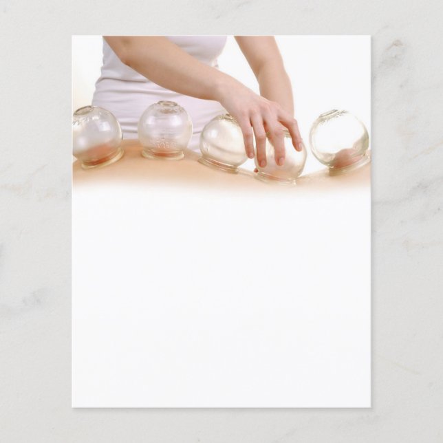 Akupunktur-Flyer Flyer (Vorne)