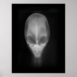 Alien Skull Röntgen Poster