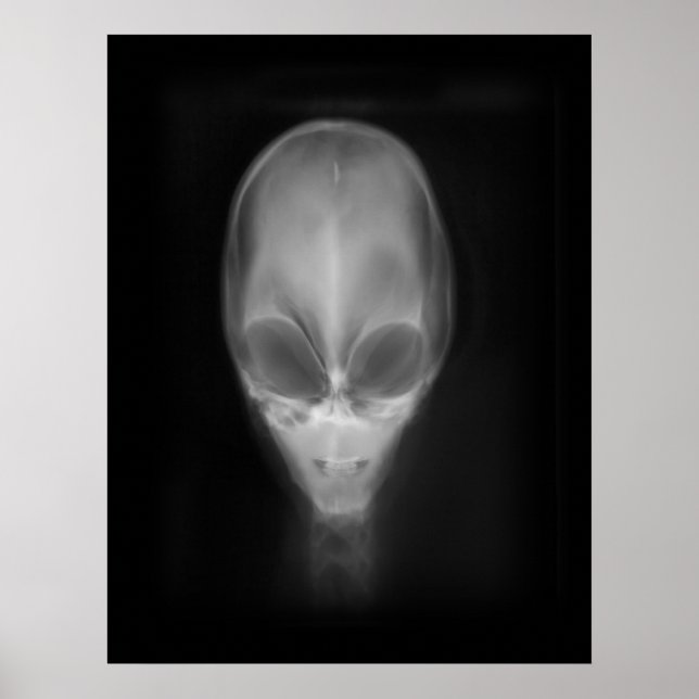 Alien Skull Röntgen Poster (Vorne)
