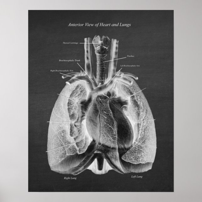 Anatomie der Lunge Herzanterieansicht Poster (Vorne)
