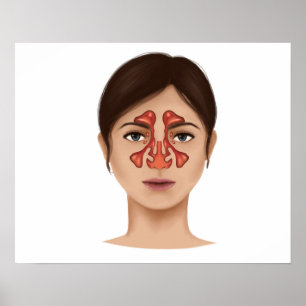 Anatomie der Nasennebenhöhlen Poster