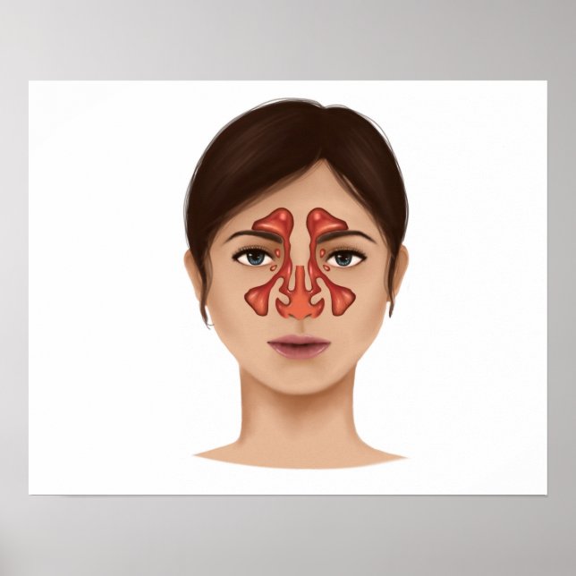 Anatomie der Nasennebenhöhlen Poster (Vorne)