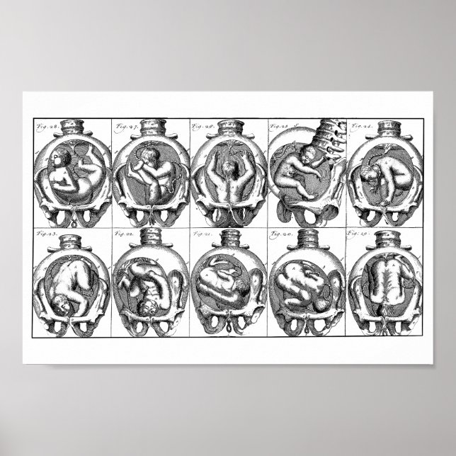 Anatomie des Babys in der Gebärmutter Vintag Poster (Vorne)