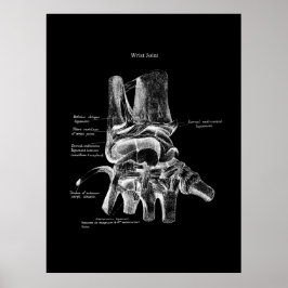 Anatomie des Handgelenks Medizinisches Poster Orth