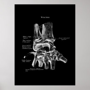 Anatomie des Handgelenks Medizinisches Poster Orth