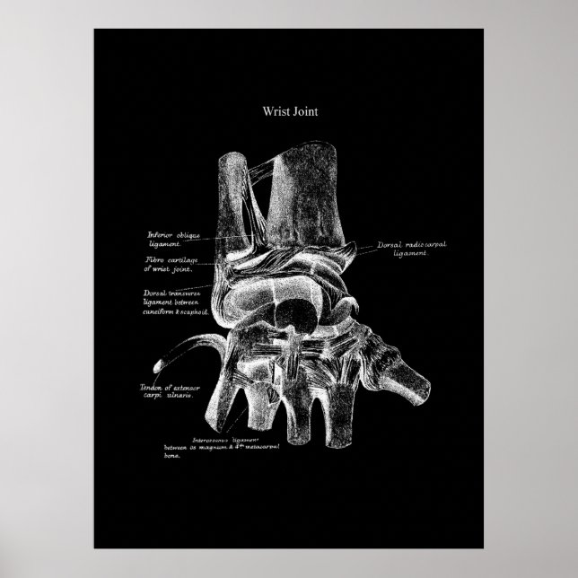Anatomie des Handgelenks Medizinisches Poster Orth (Vorne)