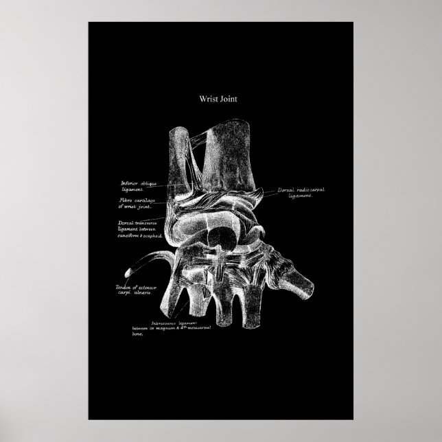 Anatomie des Handgelenks Medizinisches Poster Orth (Vorne)