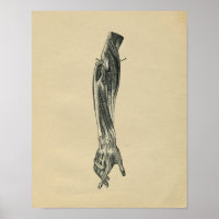 Anatomie des menschlichen Arms 1902 Vintag