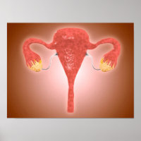 Anatomie des weiblichen Uterus mit Ovarien