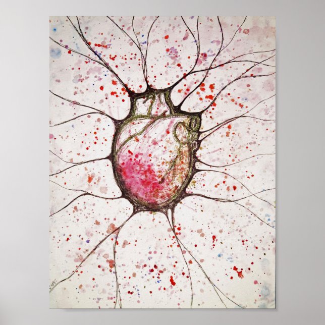 Anatomische Herzerkrankung - 8.5x11 Poster (Vorne)