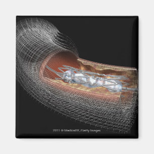 Ansicht eines angioplaty Ballons in einer Arterie Magnet