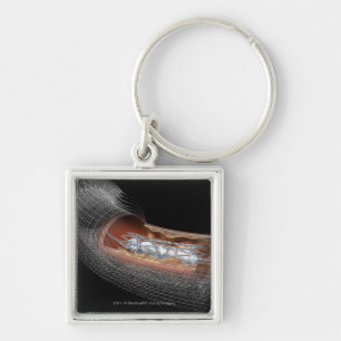 Ansicht eines angioplaty Ballons in einer Arterie Schlüsselanhänger