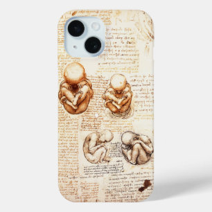 Ansichten eines Fetus in der Frau, Ob-Gyn Medical iPhone 15 Hülle