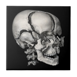 Antike Wissenschaft Menschliche Anatomie, Antiker  Fliese