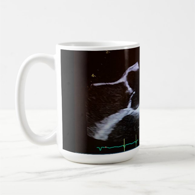 Aoraler Doppler-Echokardiogramm-Becher Kaffeetasse (Links)