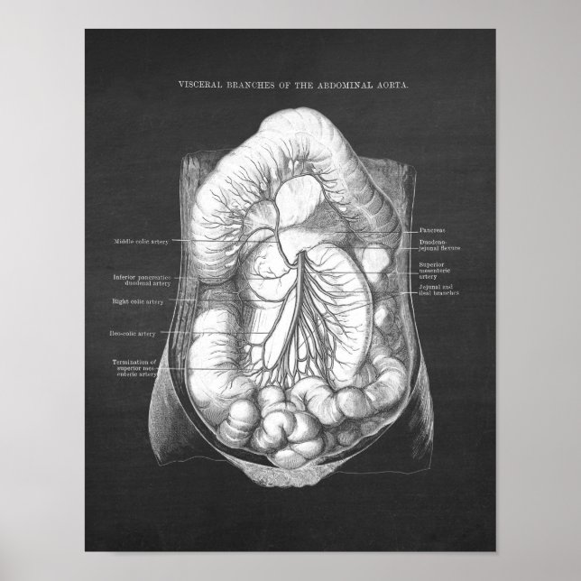 Aorta abdominale Anatomie Poster (Vorne)