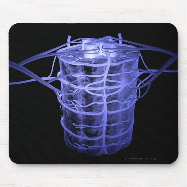 Arterien, die Teil der Wirbelsäule umgeben Mousepad (Vorne)