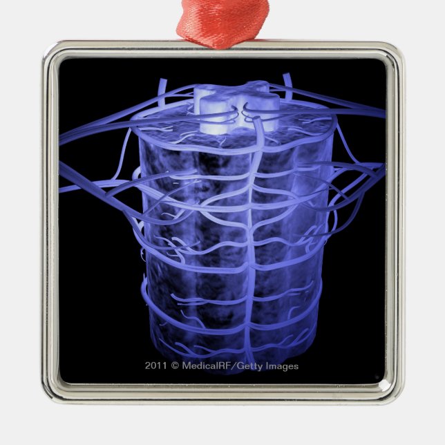 Arterien, die Teil der Wirbelsäule umgeben Silbernes Ornament (Vorne)