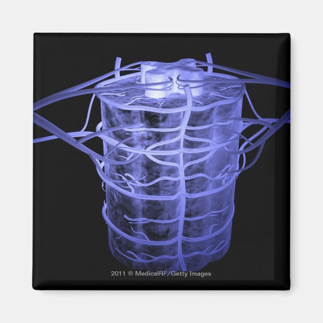 Arterien rund um einen Teil der Wirbelsäule Magnet (Vorne)