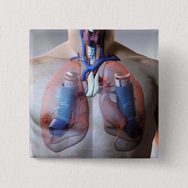 Asthma Button (Vorderseite)