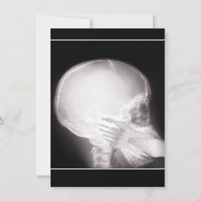 Aufnahme mit Foot in Mundröntgen Einladung (Vorderseite)