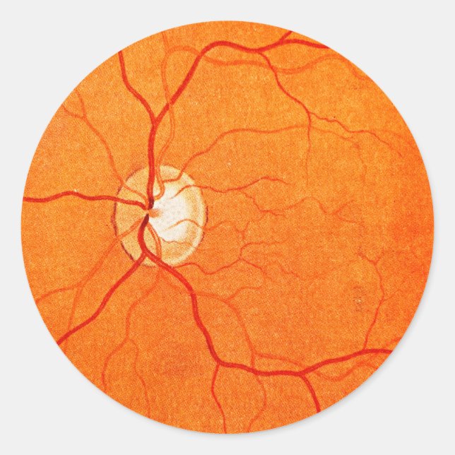 Augenfundus Examensticker Runder Aufkleber (Vorderseite)