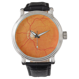 Augenuntersuchung Augenfundus Armbanduhr