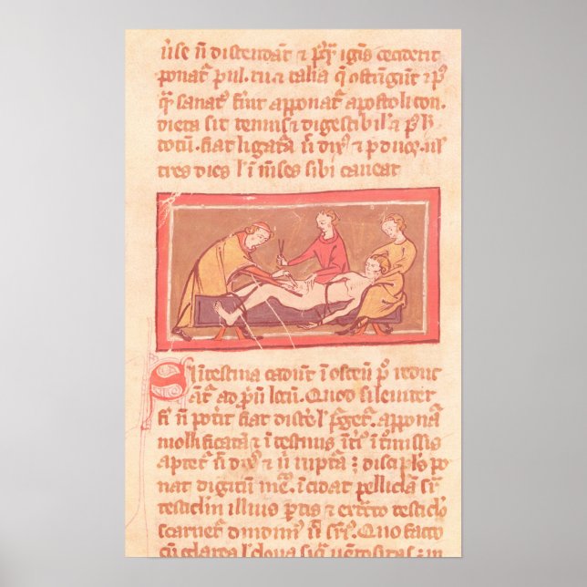 Ausgabe des Buches "Operation" von Rogier de Saler Poster (Vorne)