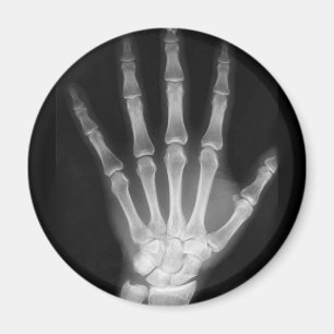 B&W Röntgen Skeleton Hand Magnet