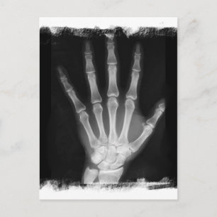 B&W Röntgen Skeleton Hand Postkarte