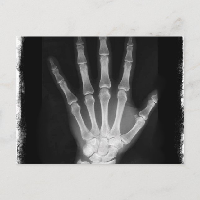 B&W Röntgen Skeleton Hand Postkarte (Vorderseite)