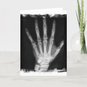 B&W X-ray Skeleton Hand Karte